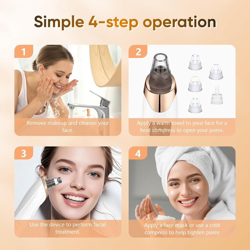 ✨🌸Oplaadbare poriënzuiger - 6-in-1 mee-etersverwijderaar met slim display en extractie k