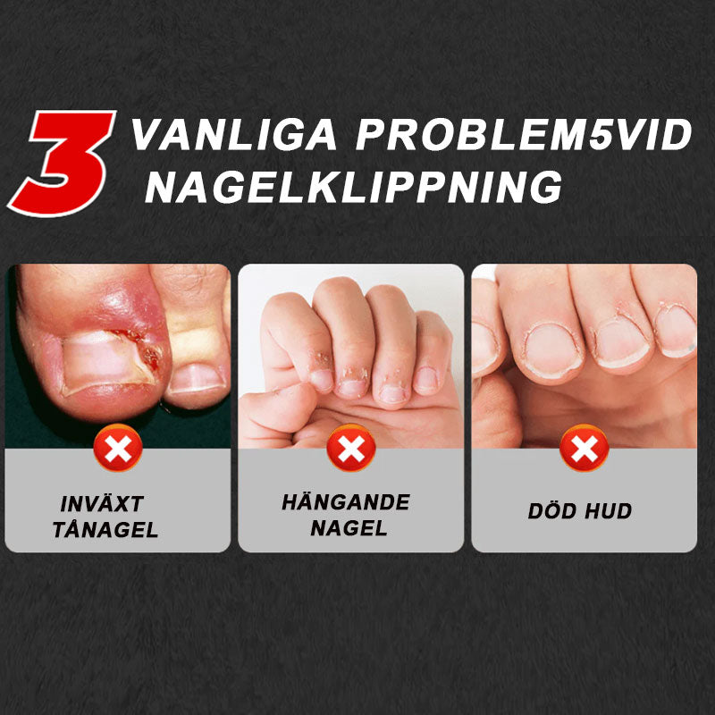🔥Populair product van 2026🔥 Spatwaterdichte nagelknipper met 25° schuin mes, 3-delige set