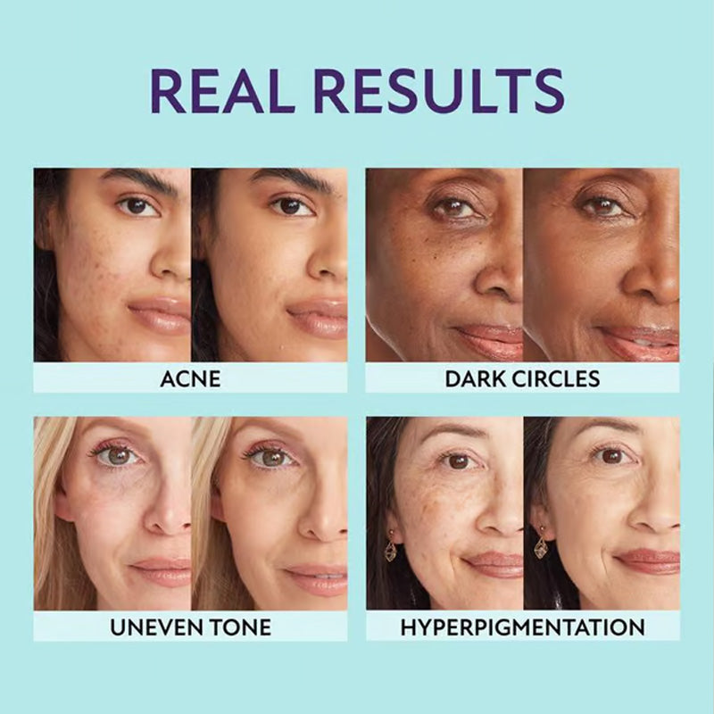 🎉All-in-one moisturiser, concealer and coverage💧✨ Lightweight and waterproo