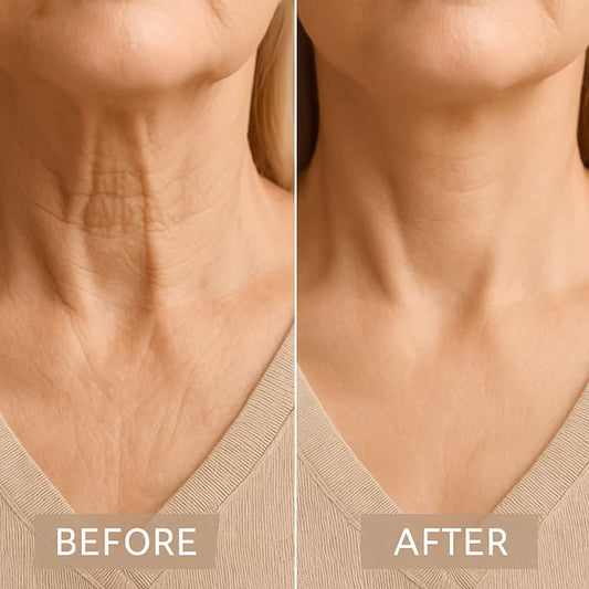 🎁Uw nek transformatie in 15 seconden😍Direct liftende ketting